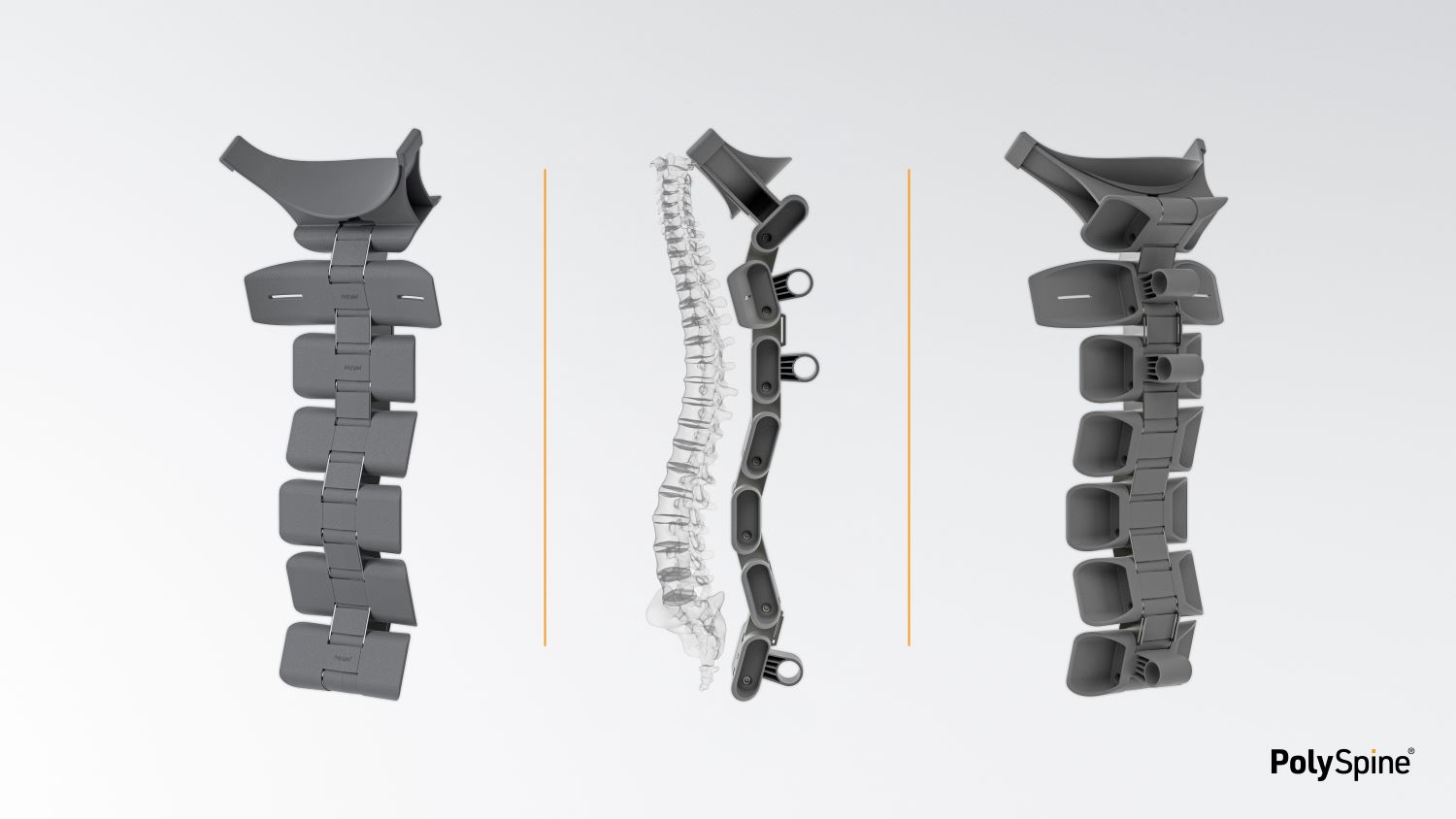 PolySpine Image