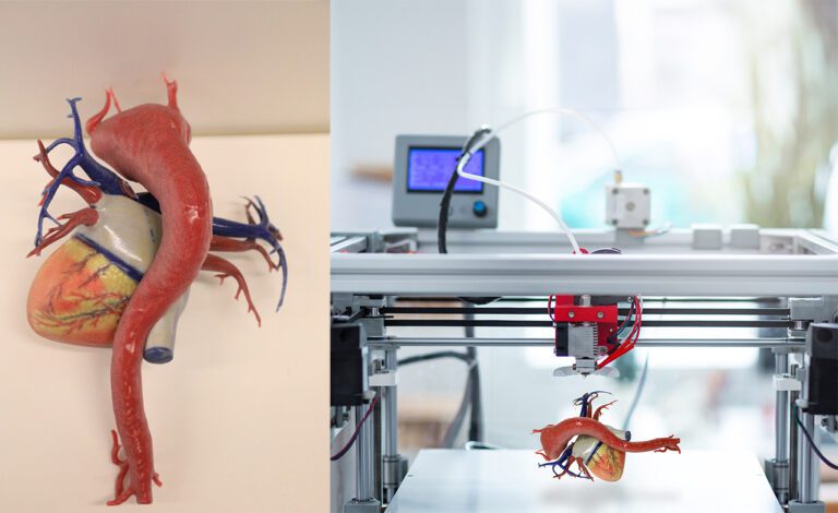 NYU-3D heart model